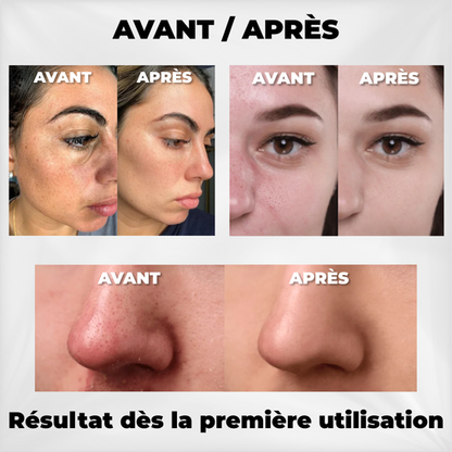 Dr. Melaxin - Exfoliant Coréen Peel Shot